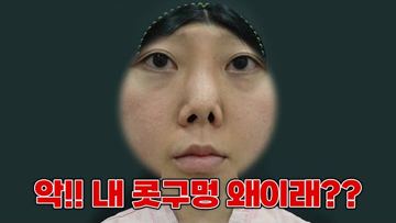 악!! 내 콧구멍 왜이래??