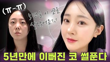 5년만에 이뻐진 코 썰푼다