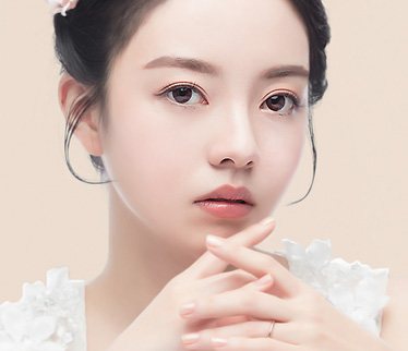복코 성형 — 두 손을 모은 모델 정면