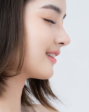 무보형물 코성형 — 눈 감고 웃는 단발 모델 옆모습