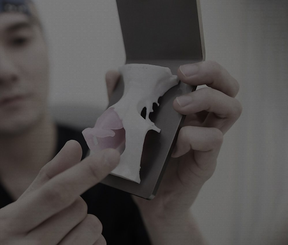 원장이 3D 프린팅 코 모형을 들어 보이는 장면(어둡게 처리)