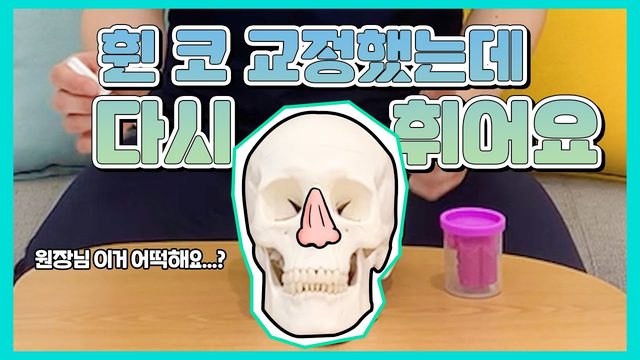 휜 코 교정했는데 다시 휘어요
