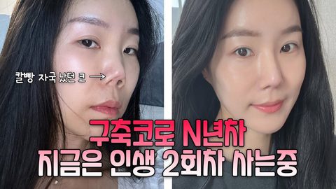구축코로 N년차 지금은 인생 2회차 사는중