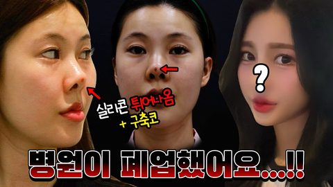 실리콘 튀어나옴 + 구축코 병원이 폐업했어요...!!