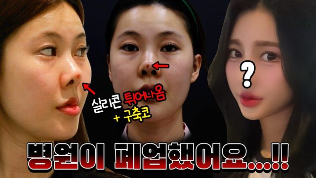 실리콘 튀어나옴 + 구축코 병원이 폐업했어요...!!
