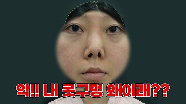 악!! 내 콧구멍 왜이래??