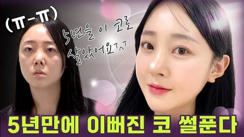 5년만에 이뻐진 코 썰푼다