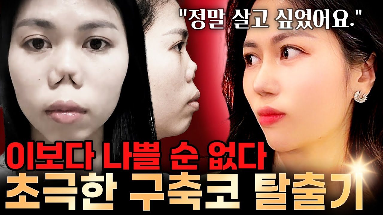 "정말 살고 싶었어요." 이보다 나쁠 순 없다 초극한 구축코 탈출기